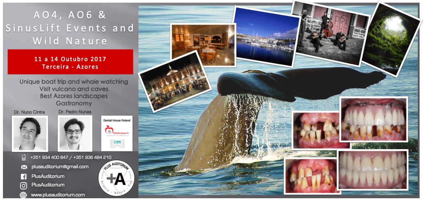 AO4, AO6 & SinusLift and Wild Nature 2017