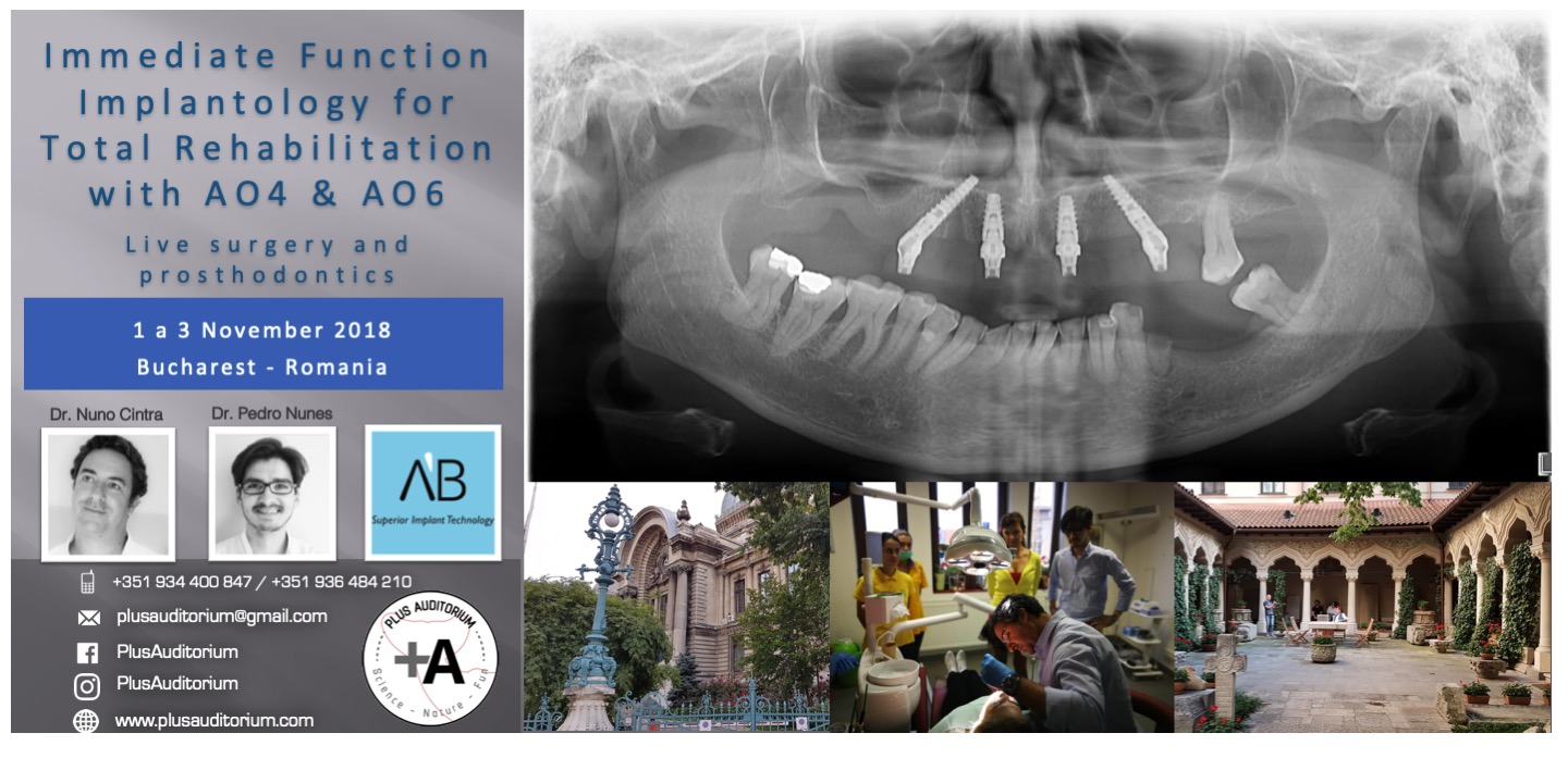 Immediate Function Implantology for Total Rehabilitation with AO4 & AO6